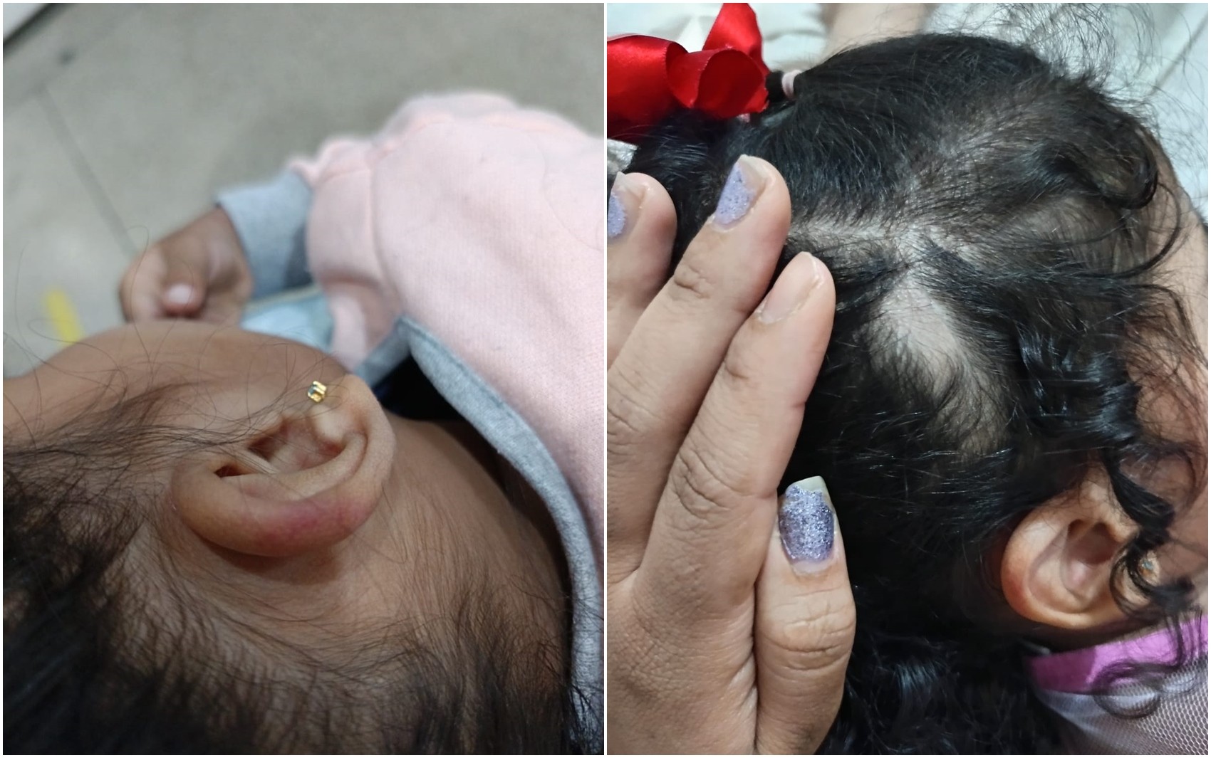 Criança tem parte do cabelo arrancada por professora em creche de Goiânia, denuncia mãe