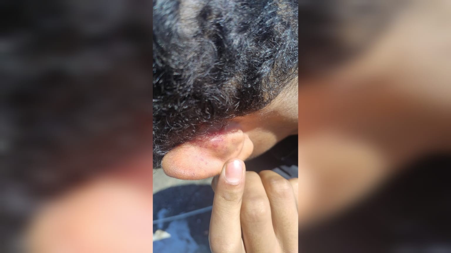 Polícia investiga denúncia de adolescente agredido por seguranças em evento da Copa em Mairinque