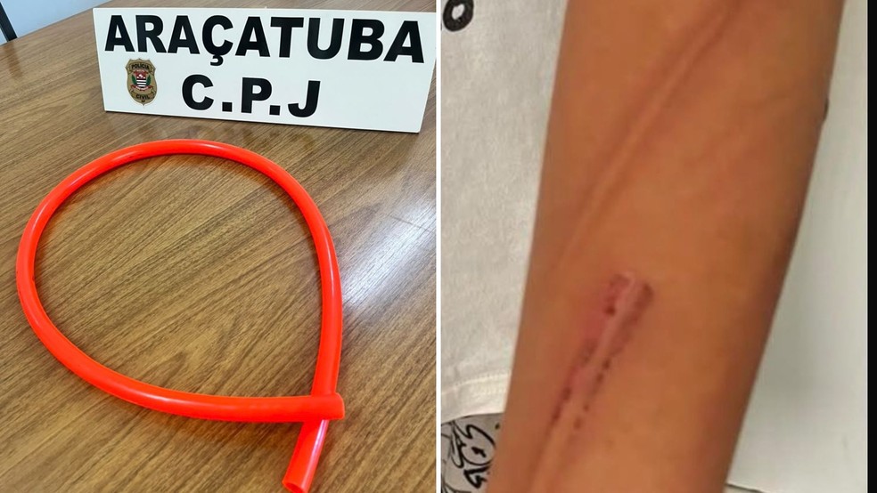 Homem é preso suspeito de espancar enteado com mangueira em Araçatuba (SP) — Foto: Arquivo pessoal