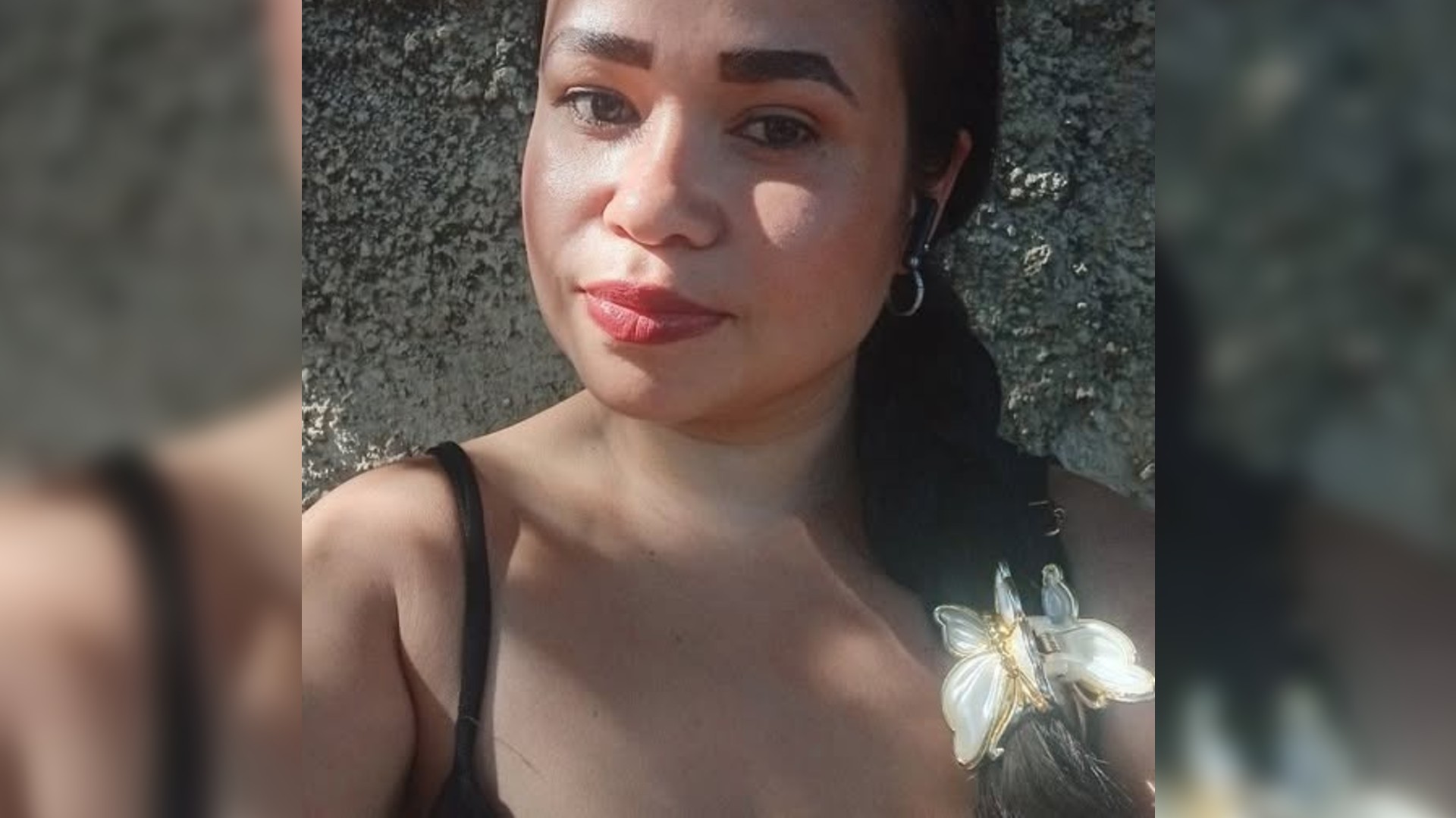 Morre mulher que teve 80% do corpo queimado pelo companheiro após três semanas internada 