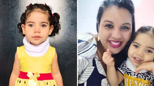 Família de menina que nasceu sem esôfago luta por cirurgia: 'não pode comer com a boca'