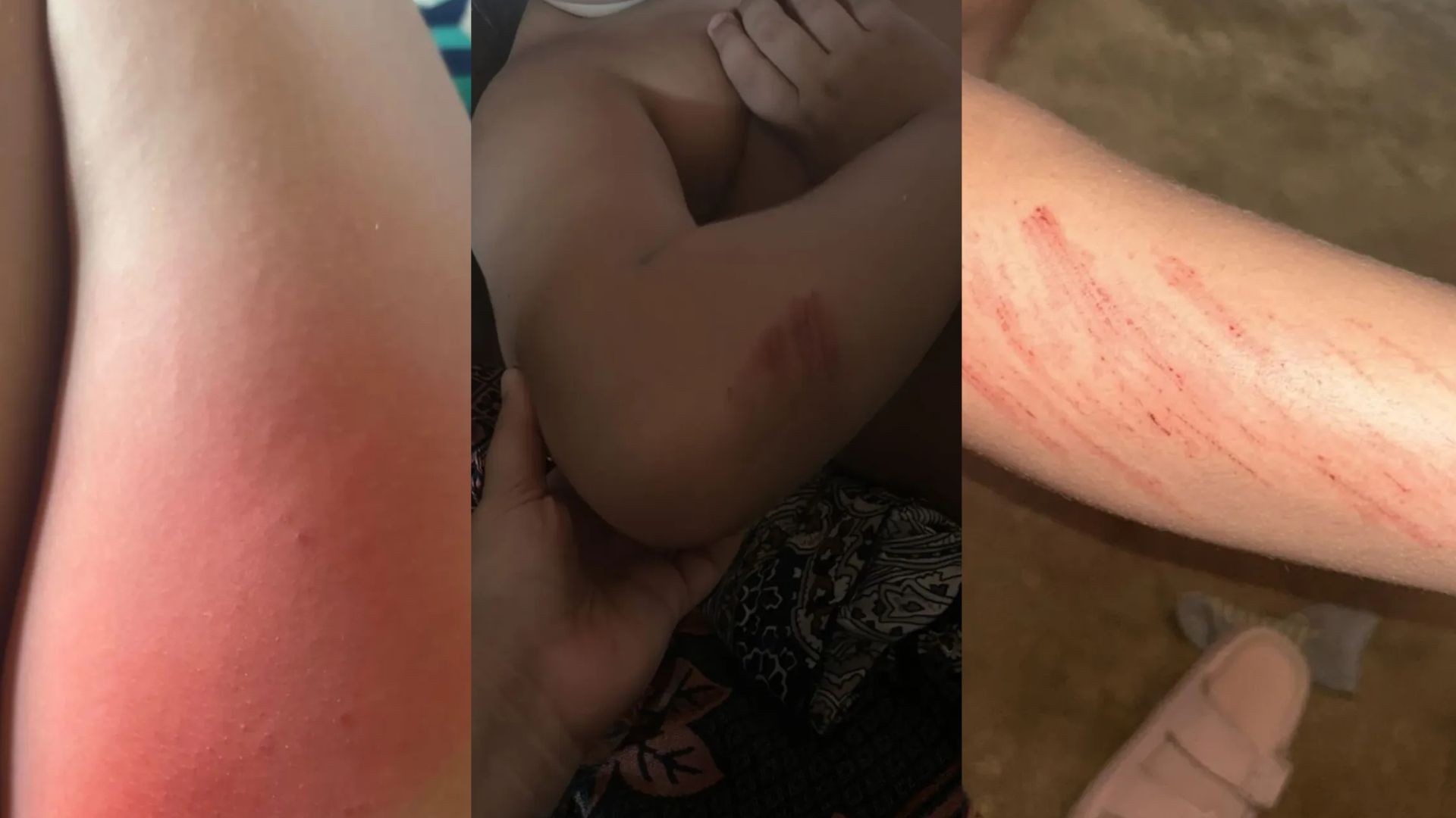 Família denuncia agressão contra criança autista de 7 anos em escola de Campina Grande