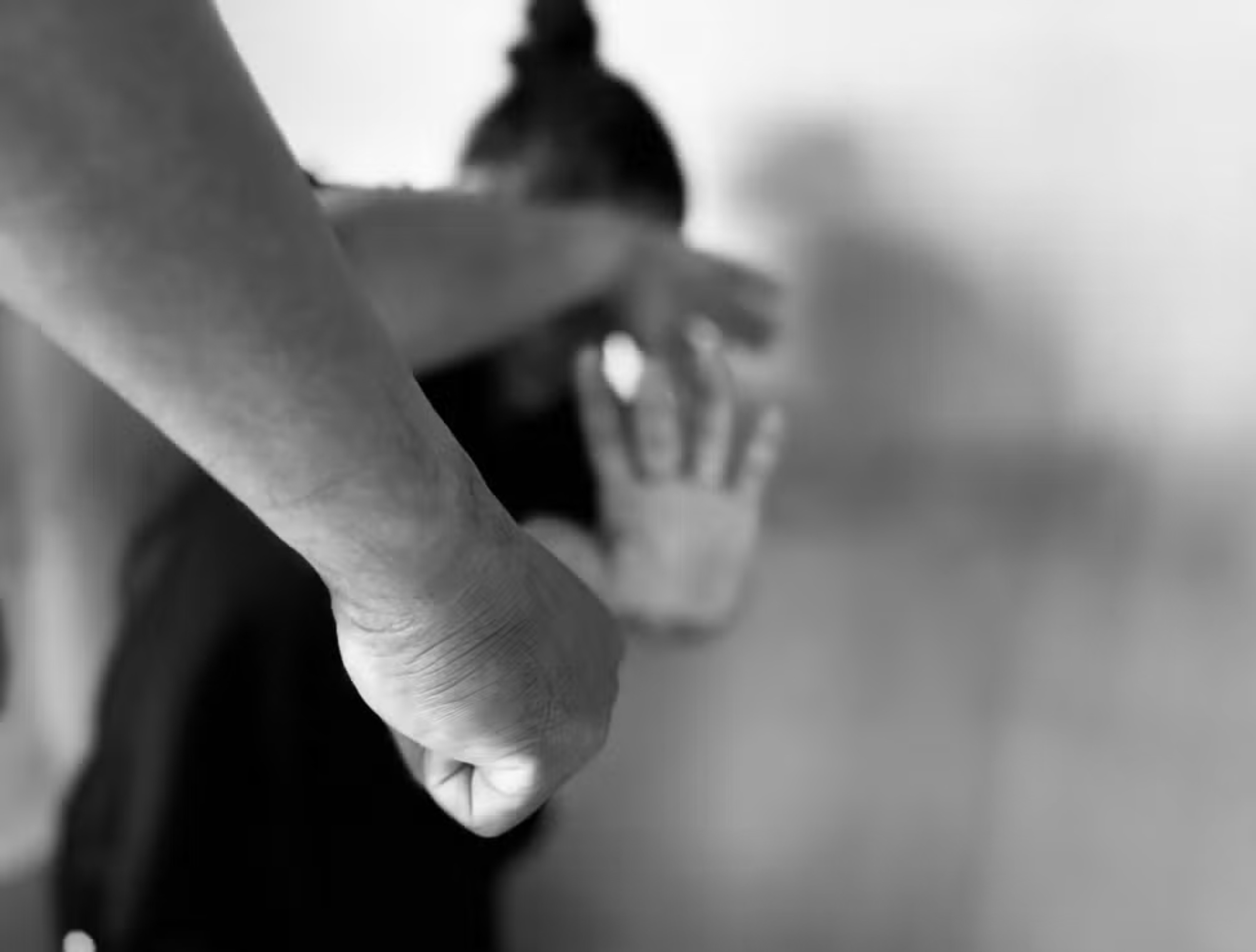 Mulher é agredida no rosto pelo marido e leva sete pontos no supercílio, em Boa Vista