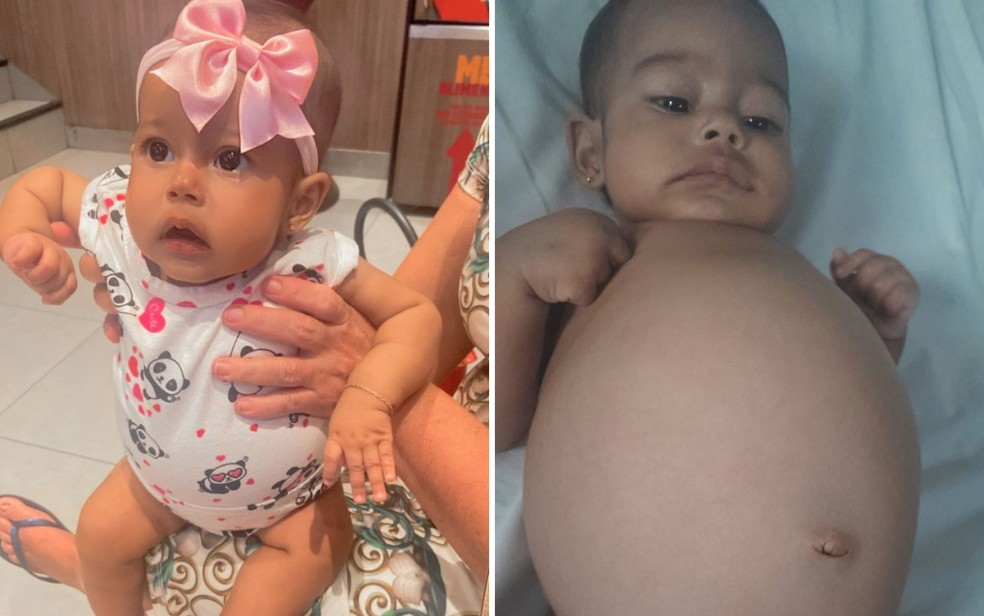 Rebeca Emanuelly Rodrigues de Sousa, de apenas 4 meses, tem suspeita de tumor na barriga — Foto: Acervo pessoal/Cleidielle Rodrigues de Sousa