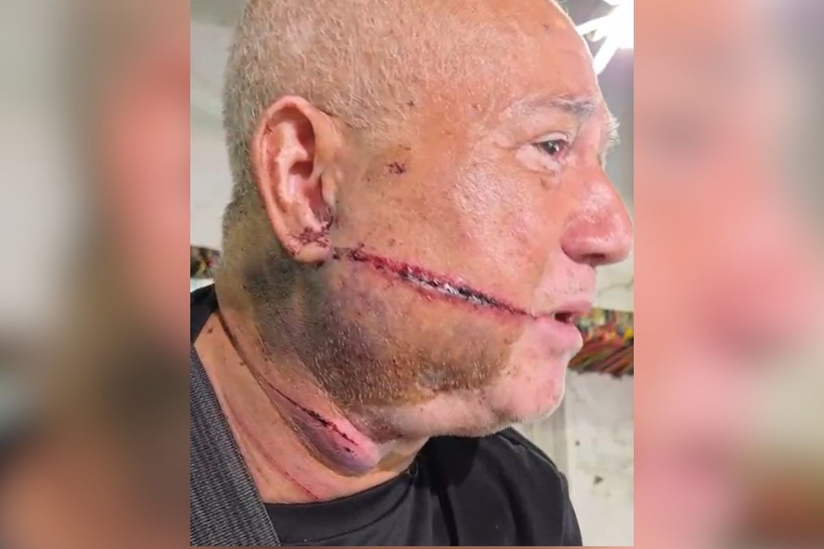 ‘Acordei com um facão no rosto’, conta dono de loja de rock de 71 anos atacado por ladrão em MS