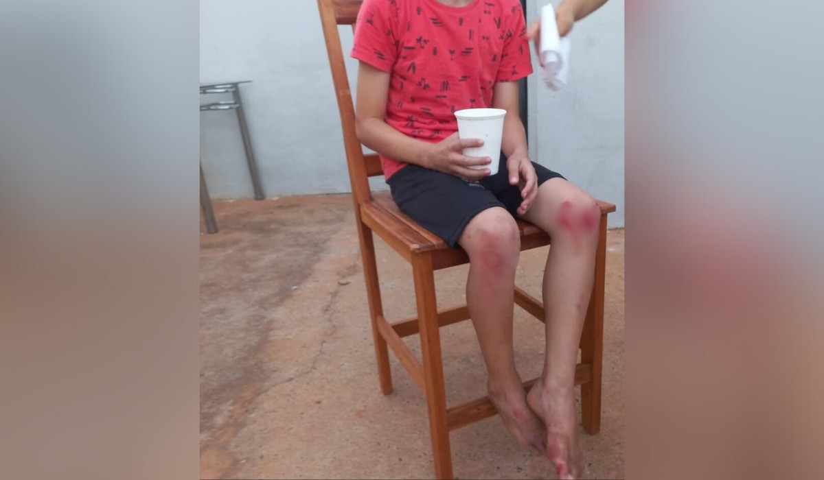 Menino de 8 anos é atropelado por moto enquanto jogava bola em frente de casa em Tupã