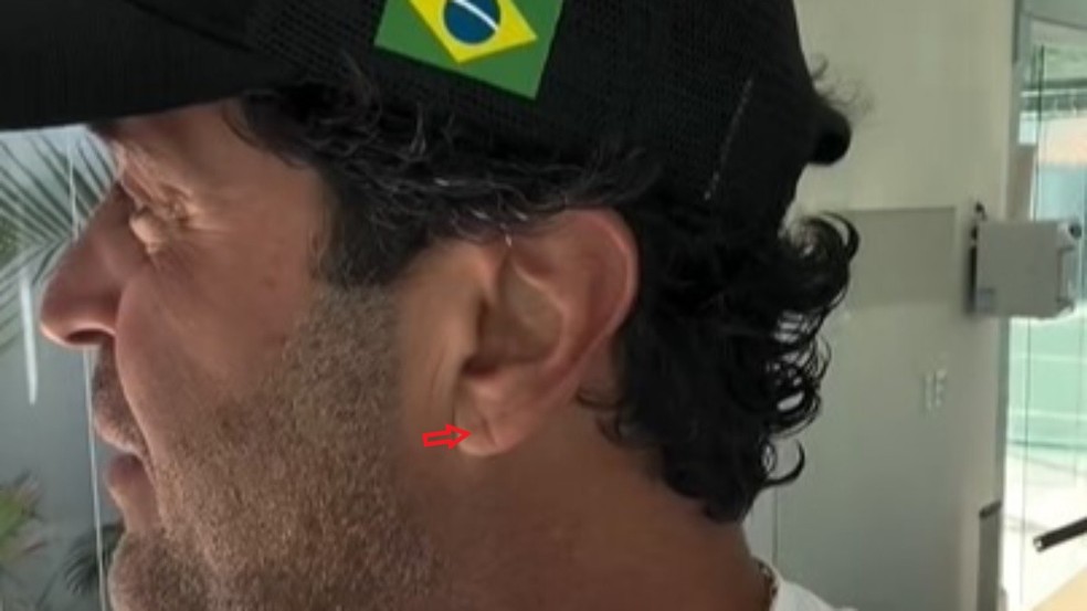 Detalhe da imagem de marca semelhante ao sinal de Frank na orelha de Henrique Maderite — Foto: Reprodução/Redes Sociais