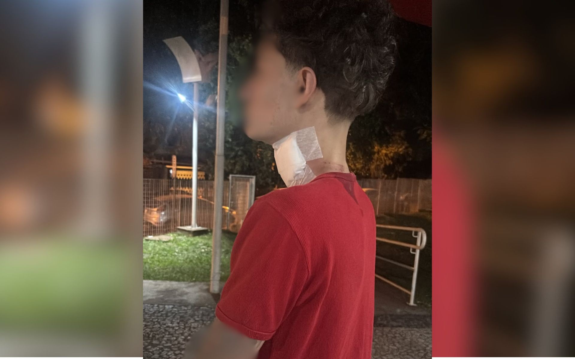 Motociclista recebe 35 pontos no pescoço após ser atingido por linha com cerol em bairro de Rio Preto