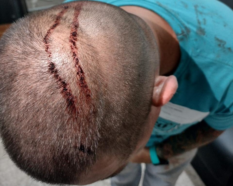 Homem é preso suspeito de tentar matar morador com golpe de facão na cabeça em Tietê