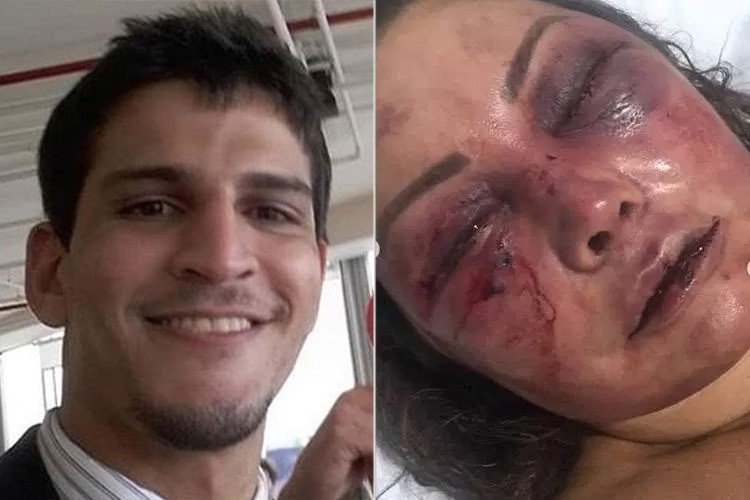 Homem que espancou paisagista é absolvido após diagnóstico de parassonia; entenda distúrbio