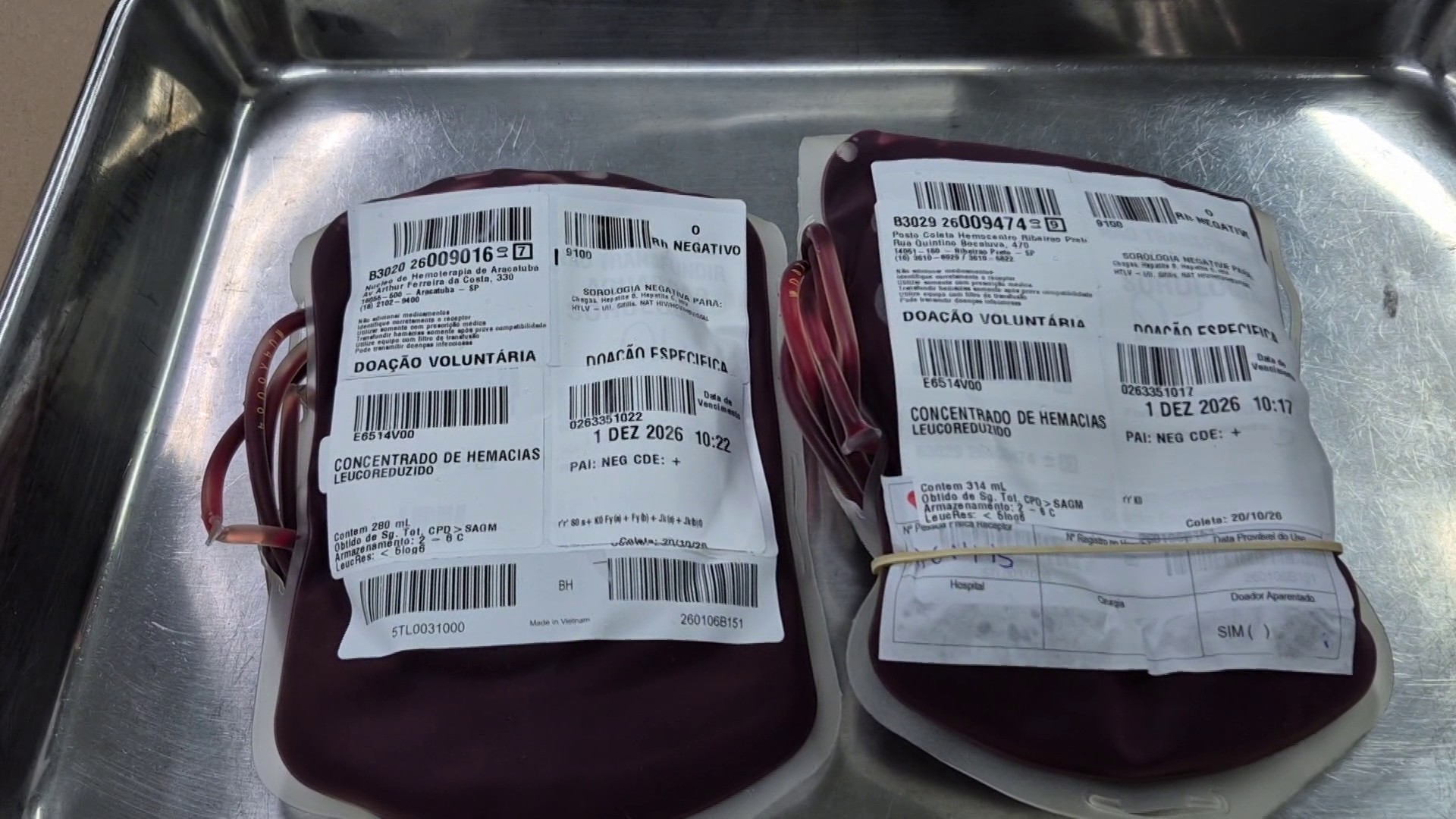 Hemocentro de Ribeirão Preto mobiliza transporte de sangue raríssimo para salvar paciente em Santa Catarina
