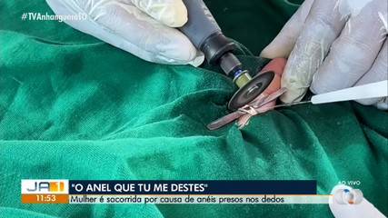 Moradora de Gurupi passa sufoco ao ficar com anéis presos aos dedos