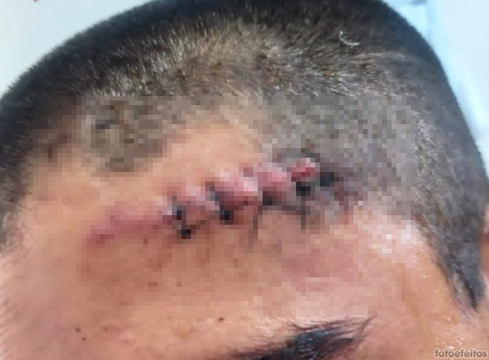 Policial ferido por lanceiros — Foto: Policia Civil