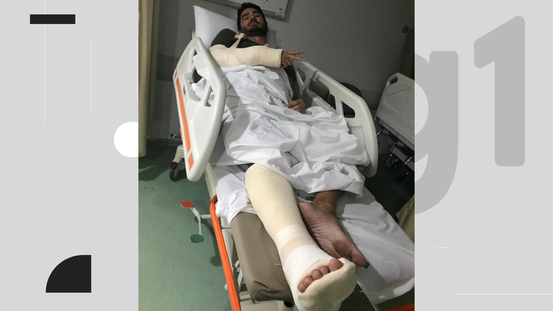 Ciclista é atropelado por patinete elétrico, sofre fratura e passa por cirurgia: 'Ainda bem que estava de capacete'