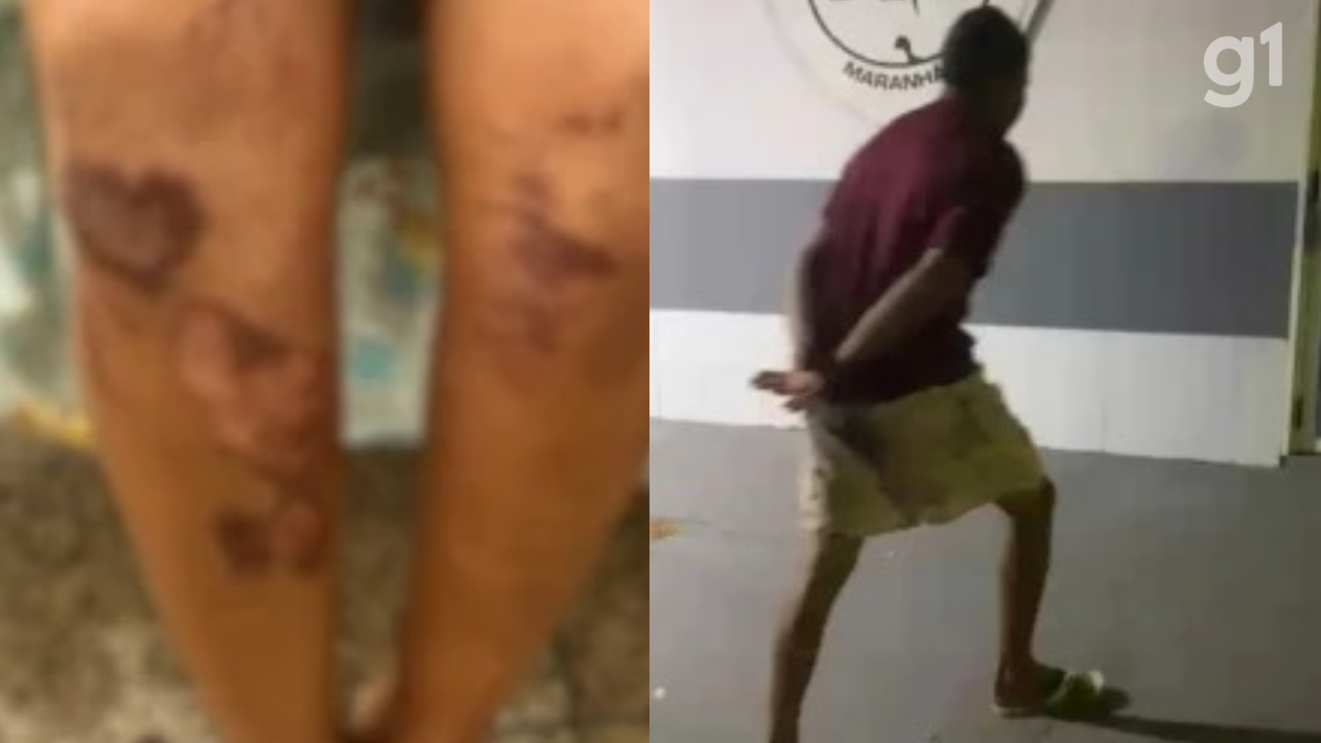 Mulher é agredida e arrastada por homem que tentou estuprá-la no MA