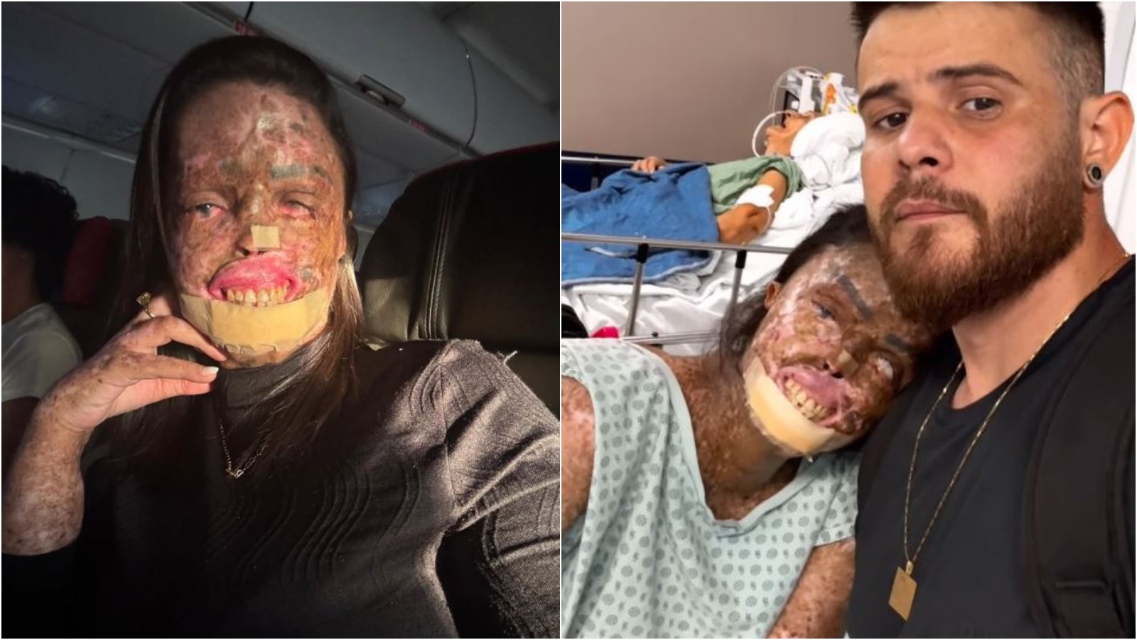 Káh Felipe, influenciadora cearense, morre após luta contra câncer raro