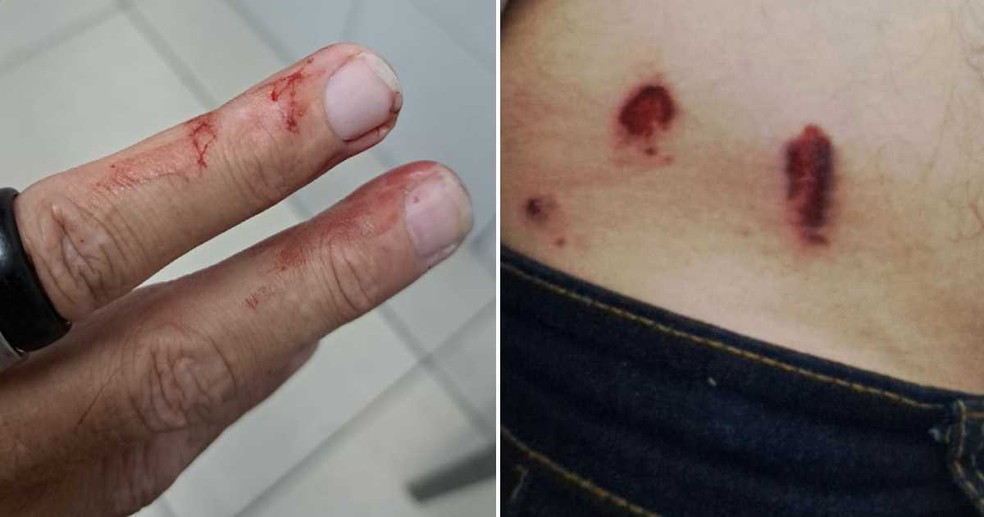 Torcedor ficou ferido após ataque de motociclistas a ônibus em Fortaleza — Foto: Arquivo pessoal