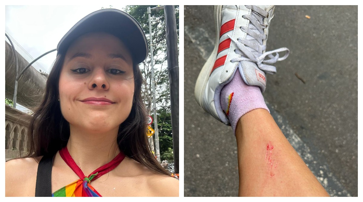 Foliã se machuca ao escalar semáforo para fugir de multidão em bloco do Calvin Harris: 'Foram cenas de terror'