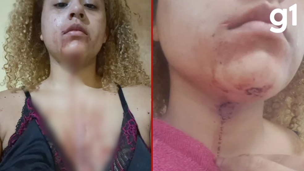 Jovem relata ter sido agredida por policiais e atingida na região do rosto por policiais. — Foto: Redes sociais