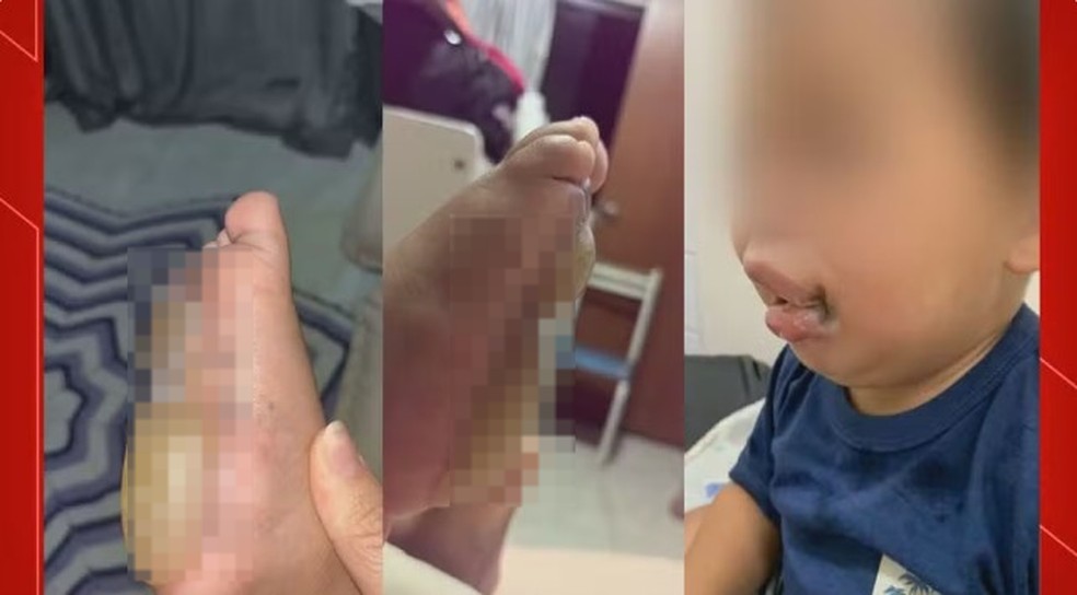 Crianças sofrem queimaduras em creche no Gama, no Distrito Federal. — Foto: TV Globo