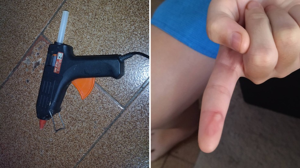 Mãe denuncia professora suspeita de queimar alunos com bastão de cola quente como 'castigo' em Birigui (SP) — Foto: Reprodução/TV TEM