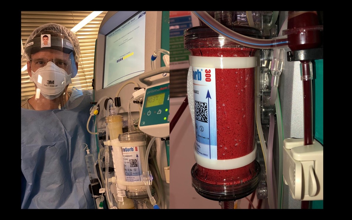 Processo Artificial De Filtragem Do Sangue - RETOEDU