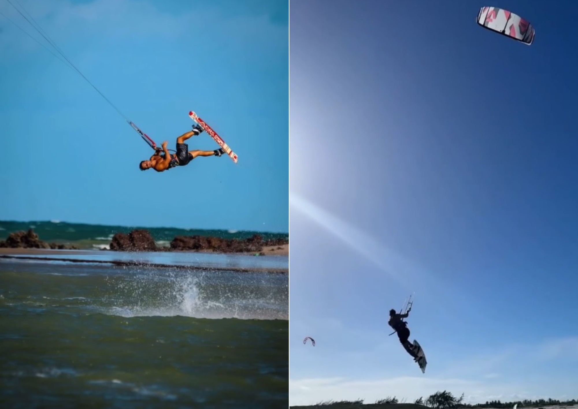 Ex-deputado federal sofre acidente de kitesurfe e é internado em UTI após passar por cirurgia em Natal