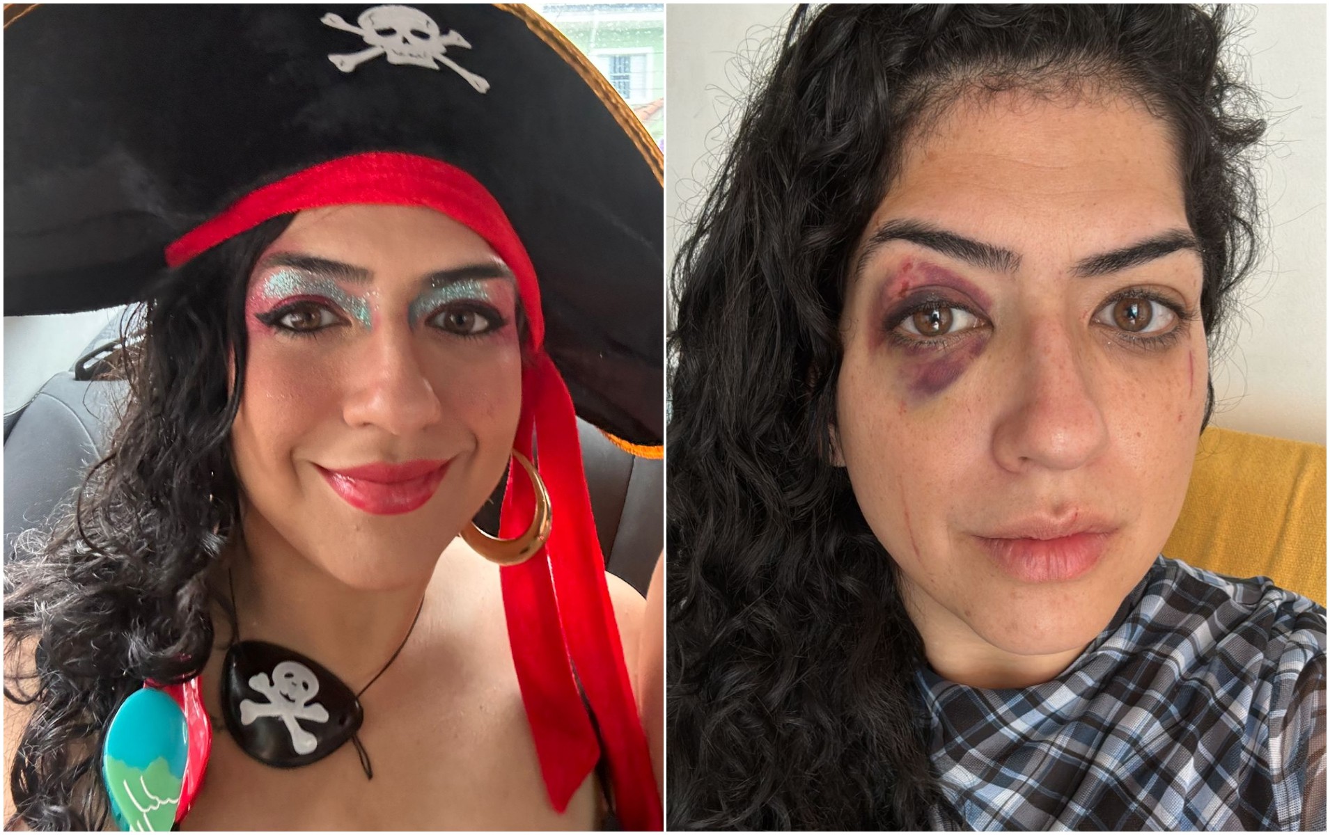 Publicitária é agredida por dona de bar após pedir cigarro para marido dela no Centro de SP; comerciante diz que foi legítima defesa 