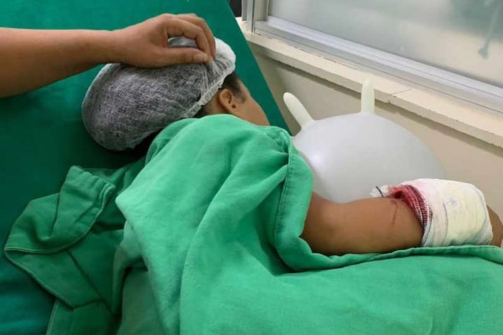 Menina baleada no braço durante confronto entre PM e criminosos durante atendimento médico em Cubatão, SP — Foto: Reprodução