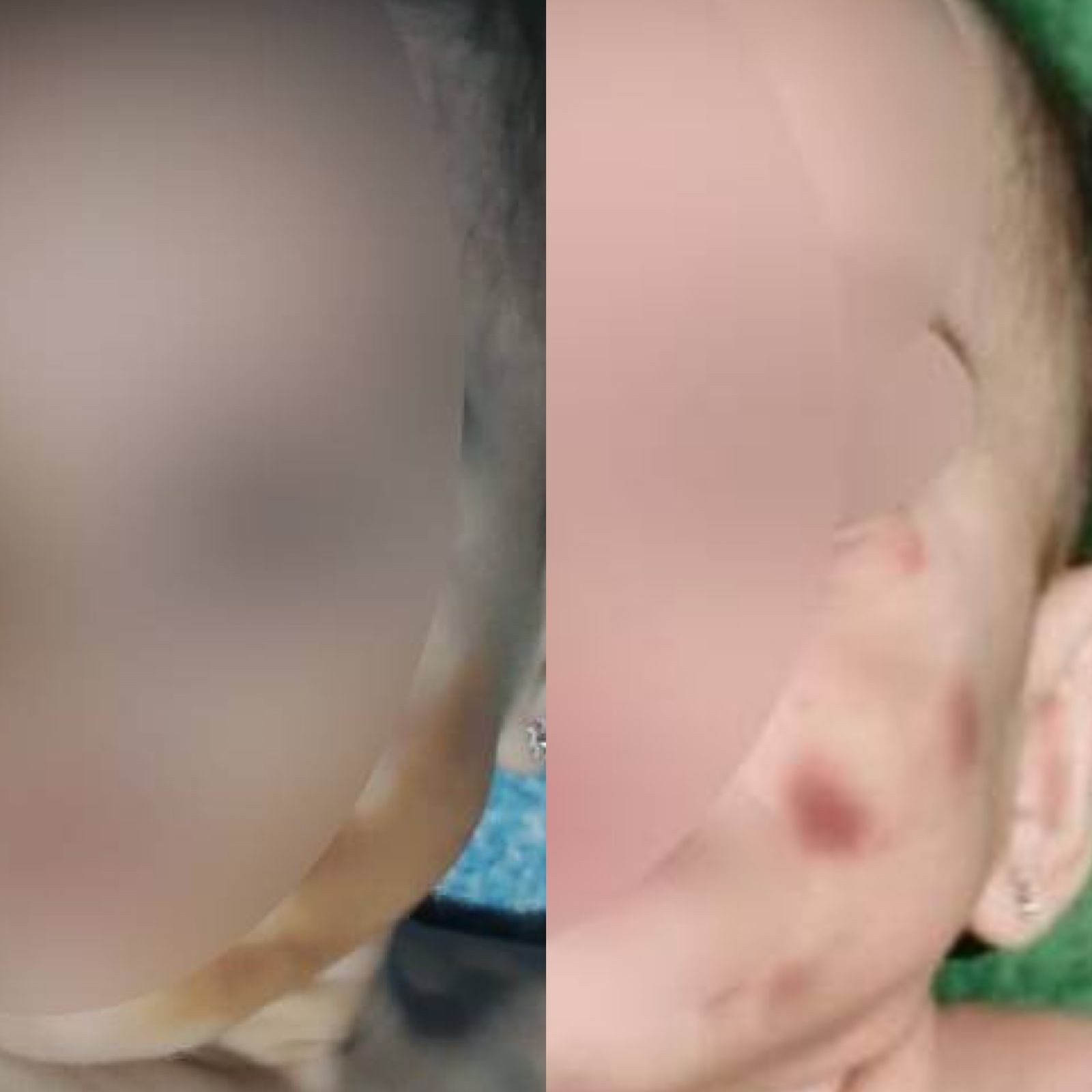 Mãe suspeita de maquiar rosto de bebê para esconder hematomas é indiciada pela polícia de MT 