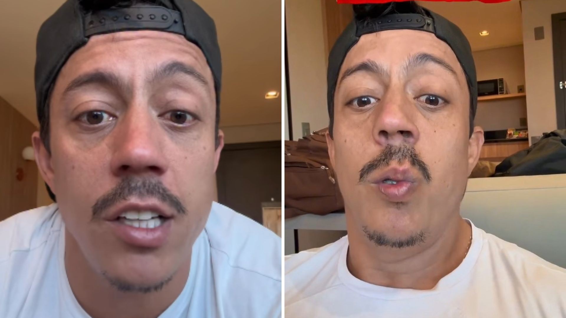 Humorista Renato Albani revela diagnóstico de paralisia de Bell: 'parece que tomei anestesia de dentista'; VÍDEO