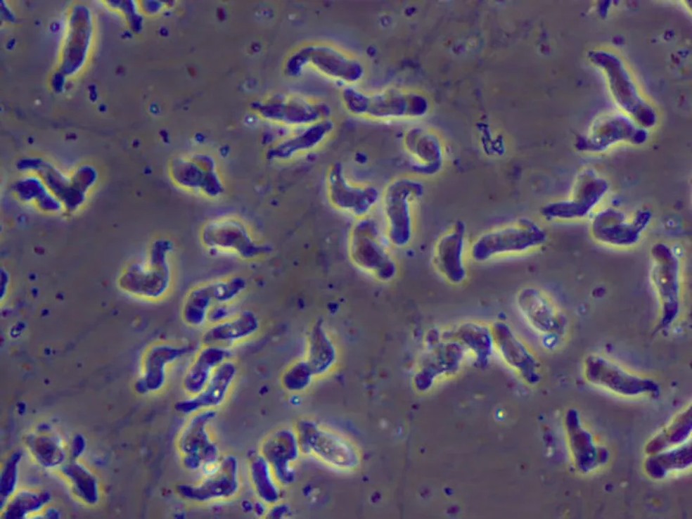 Ameba Naegleria fowleri, conhecida como 'comedora de cérebros' — Foto: CDC/Divulgação