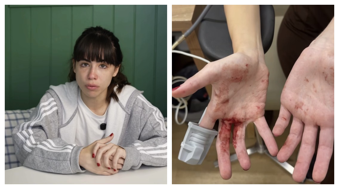 Atriz Nina Baiocchi diz que reagiu a assalto em carro de aplicativo em SP e ficou ferida com cacos de vidro: 'Impotente'