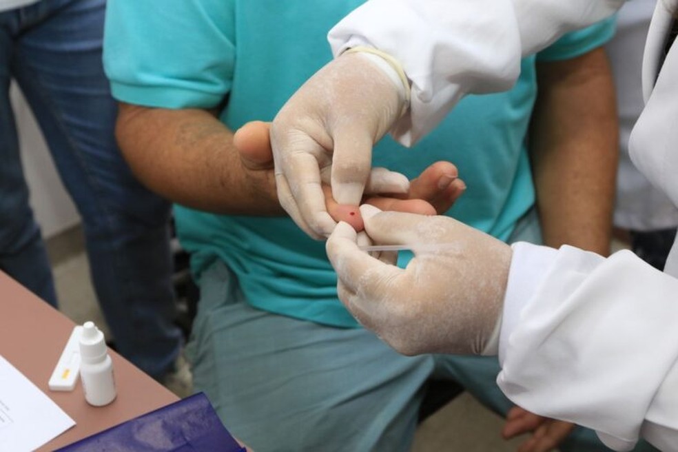 Teste rápido para diagnóstico da hanseníase — Foto: Sandro Araújo/Agência Saúde-DF
