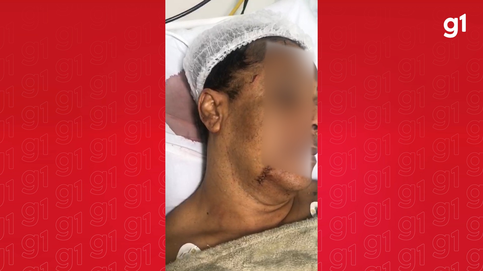 Mulher trans denuncia tentativa de feminicídio em Madre de Deus