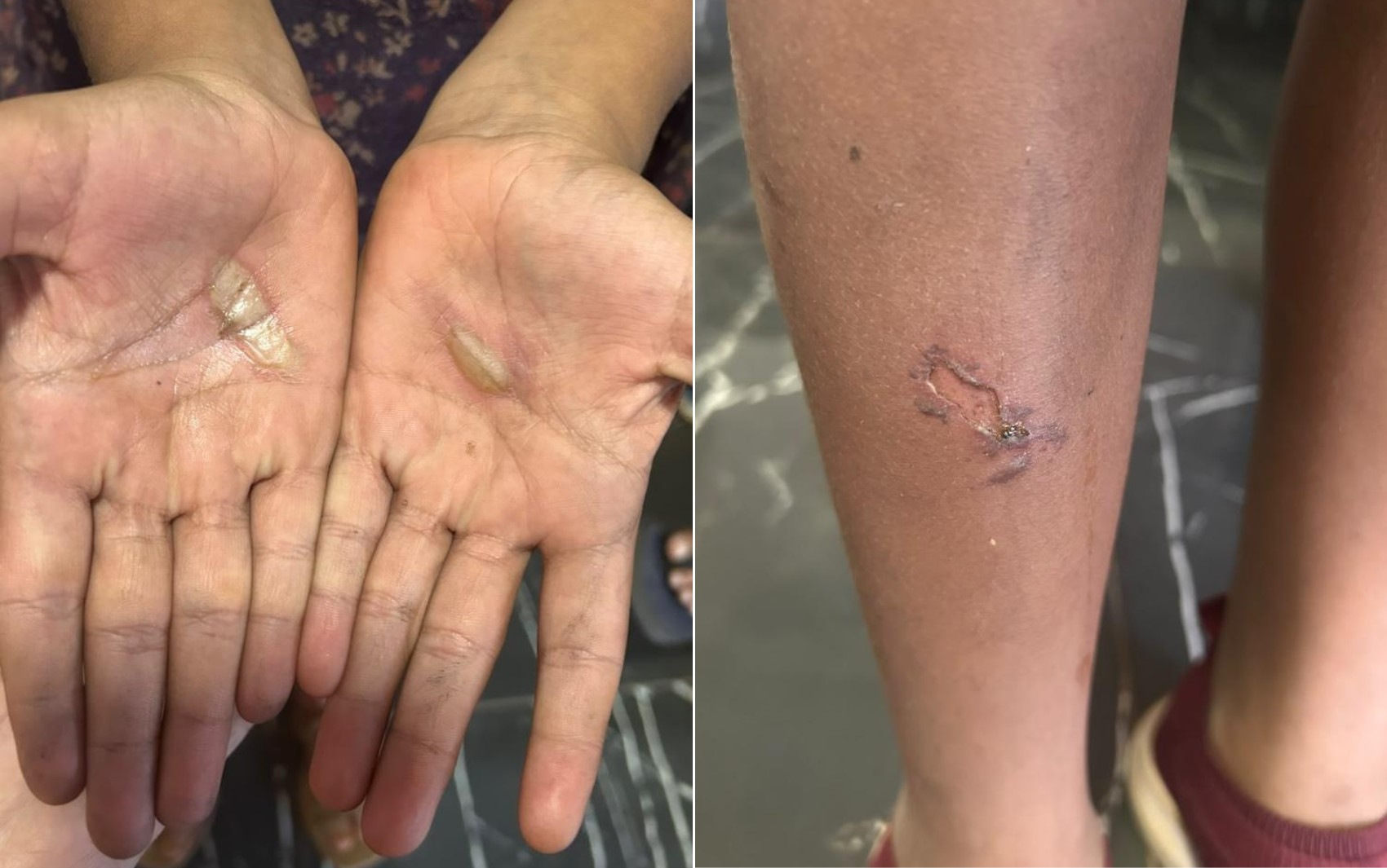 Pai é preso suspeito de torturar filhas após elas quebrarem acidentalmente caixa de som
