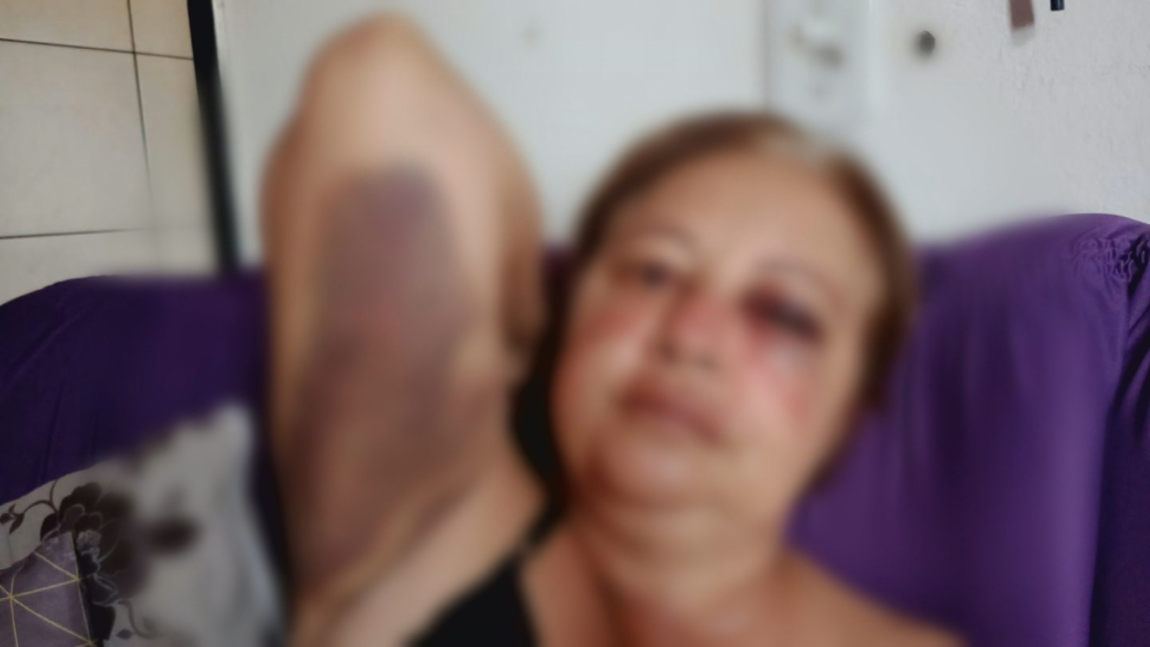 Servidora pública espanca mulher após receber mensagens ofensivas e é exonerada 