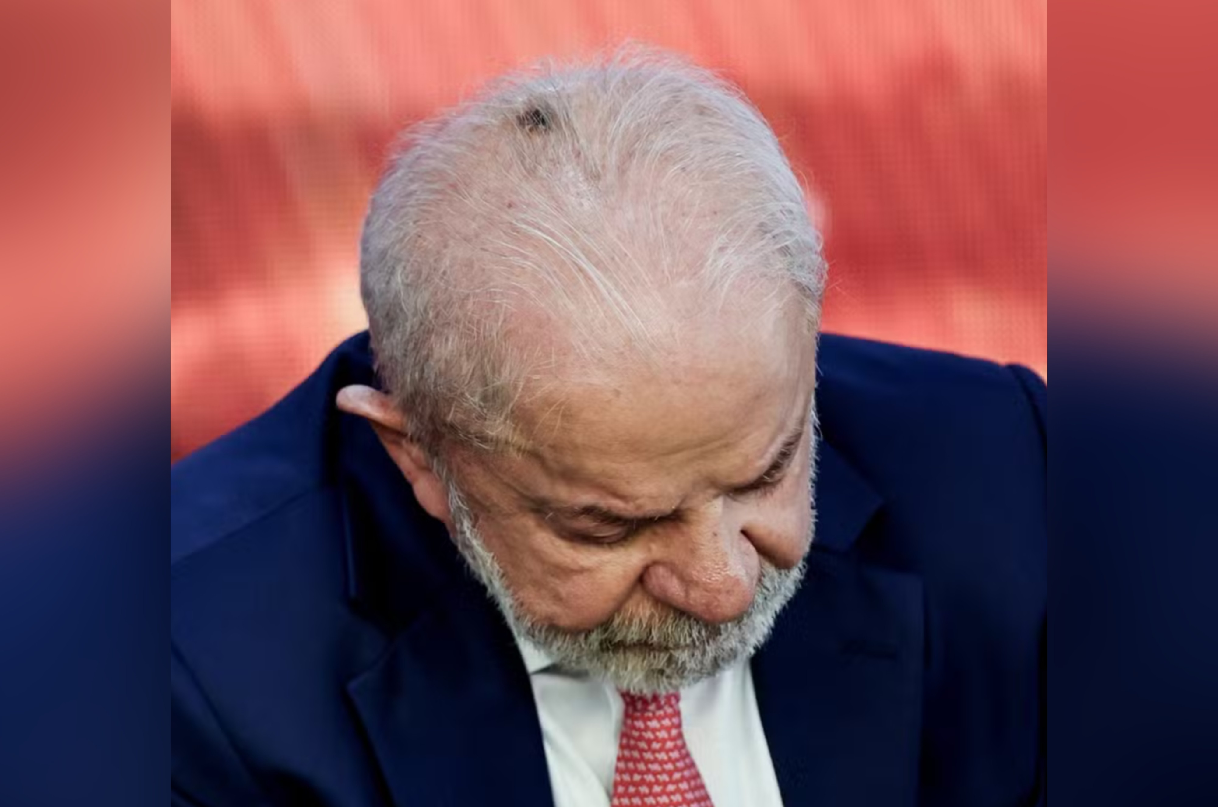 Lula passará por procedimento para retirada de queratose e infiltração em punho para tratar tendinite, diz Planalto
