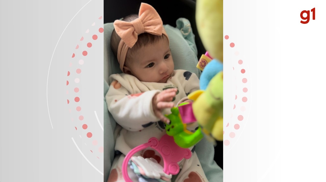 Com síndrome rara, bebê nascida em SC não tem expressões faciais: 'Sorri com a alma', diz mãe