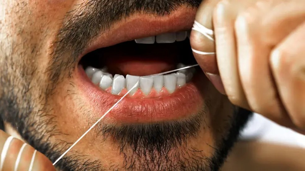 O uso de fio dental é recomendado principalmente para as pessoas que não conseguem escovar os dentes adequadamente mais de uma vez por dia — Foto: Getty Images via BBC