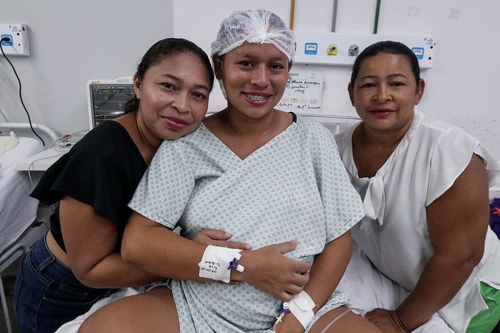 Gêmeas siamesas unidas pelo abdômen nascem em parto raro em maternidade pública de Manaus — Foto: Divulgação/Secom