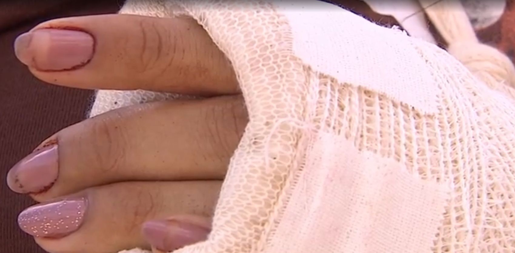 ‘Eu vi a morte de perto’, diz jovem vítima de tentativa de feminicídio em Sergipe