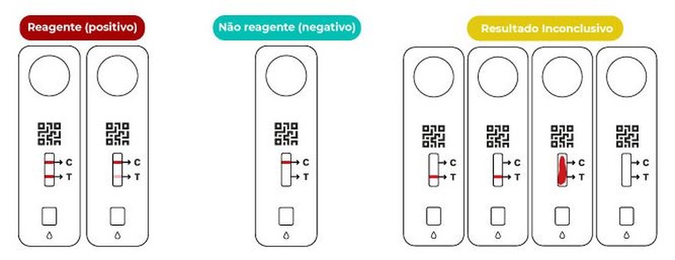 Metade dos testes de Covid da rede Dasa têm resultado positivo - 18/01/2022  - Equilíbrio e Saúde - Folha