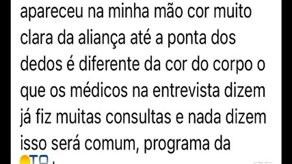 Especialista tira dúvidas sobre a saúde das unhas no Bom Dia Responde