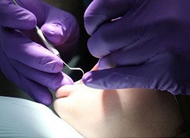 Clínica odontológica é condenada por extrair dente errado de paciente no DF