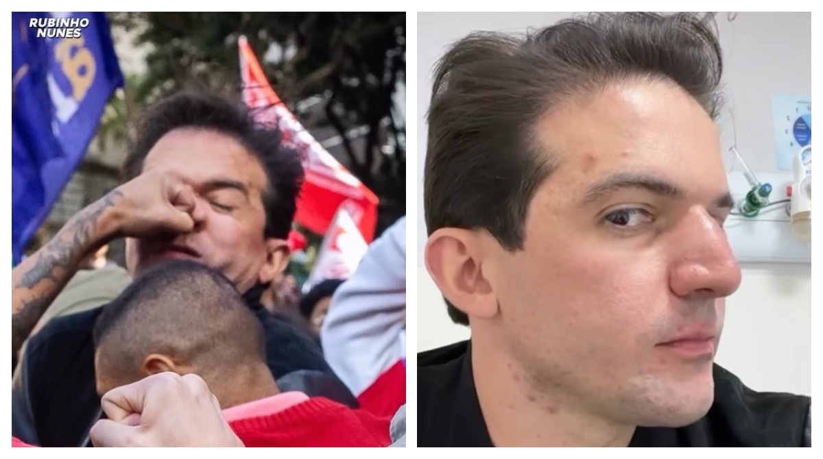Vereador diz que fraturou nariz em ato de estudantes em SP; oposição critica presença: 'arranja briga para se fazer de coitado'