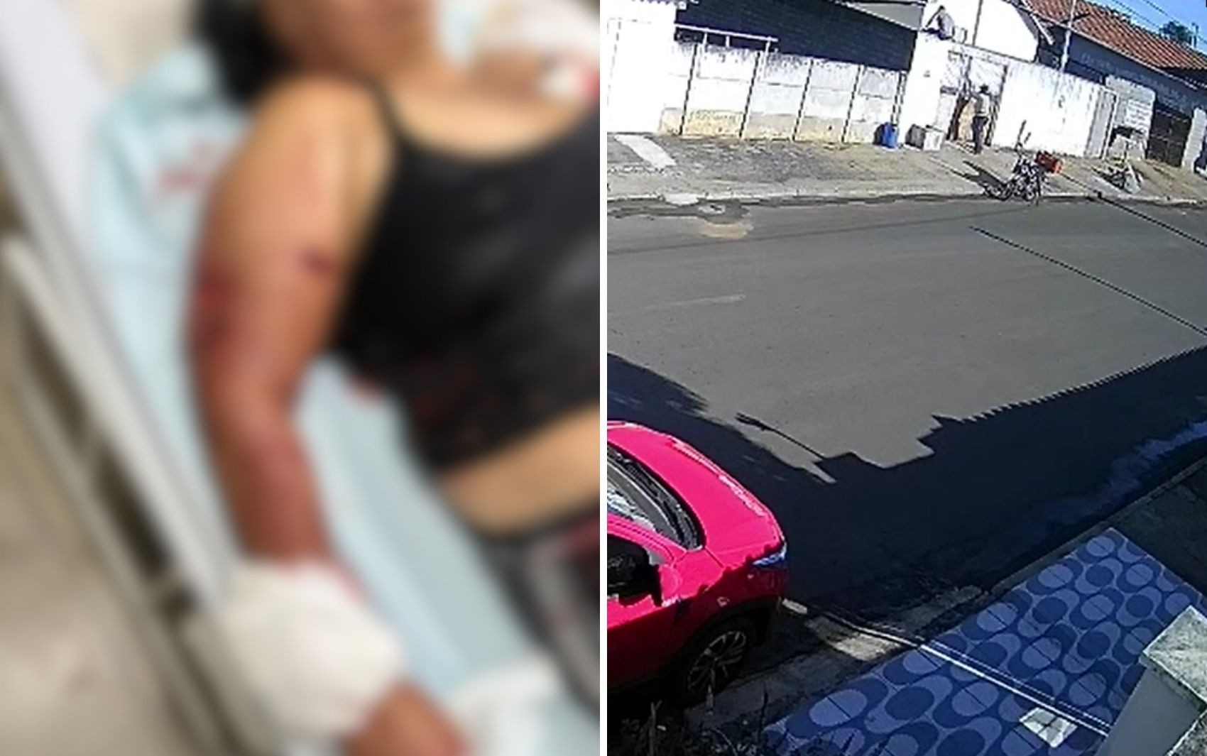 Vizinhos tentam pular muro para impedir pit bull de atacar avó enquanto ela protegia bebê; vídeo