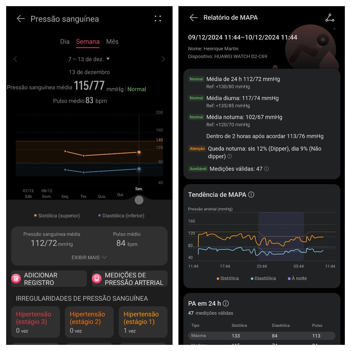 Tecnologia vestível: g1 testa anel, óculos e relógio que fazem mais do que aparentam