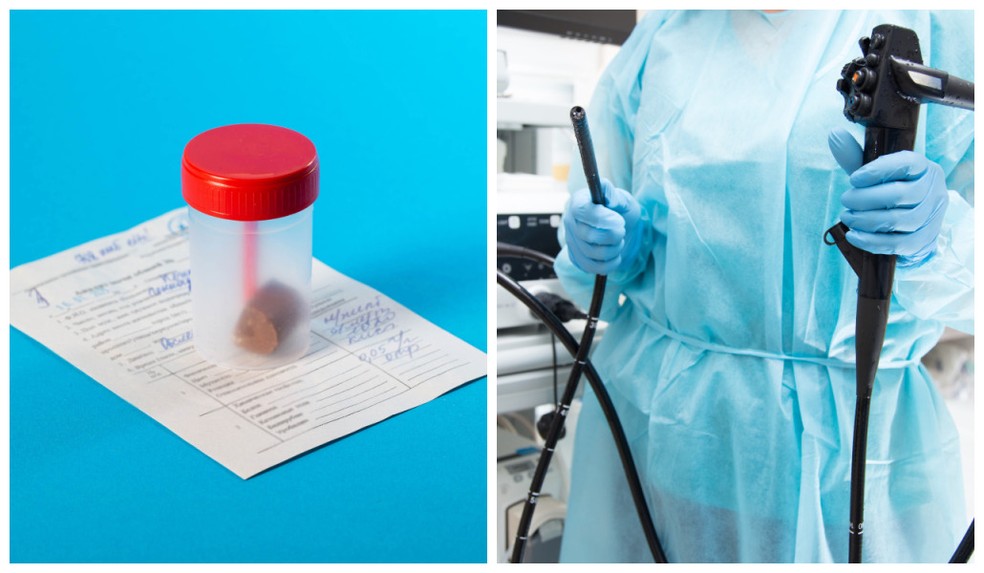 Sangue oculto nas fezes e colonoscopia: como identificar e prevenir o câncer colorretal — Foto: Adobe Stock