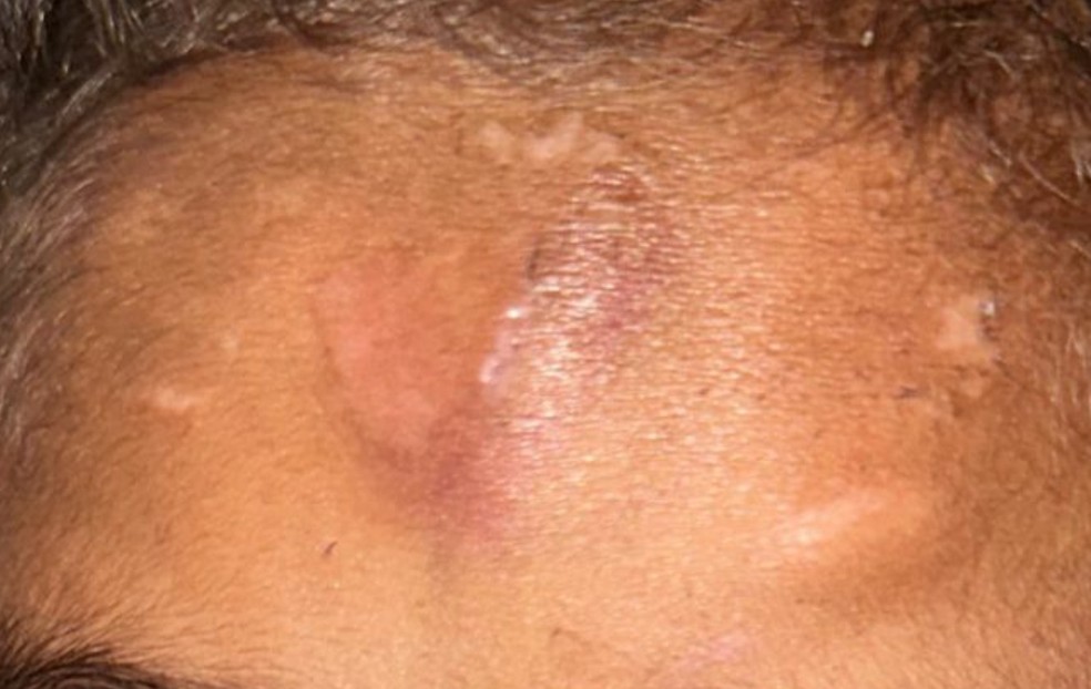 Criança era agredida pelos pais adotivos no oeste da Bahia — Foto: Redes sociais